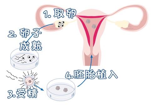 供卵代生网
